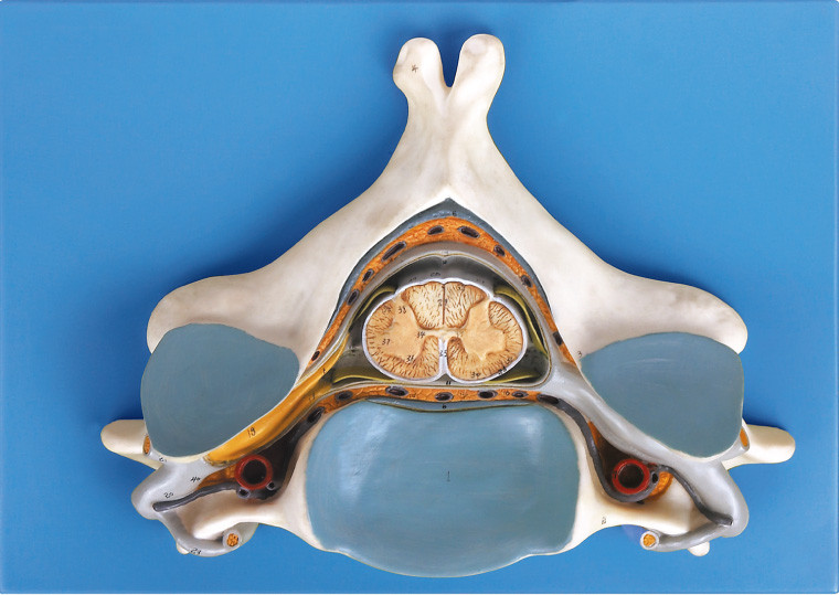 Quinto Vertrebra cervical con el modelo esquelético humano anatómico de la médula espinal y del nervio