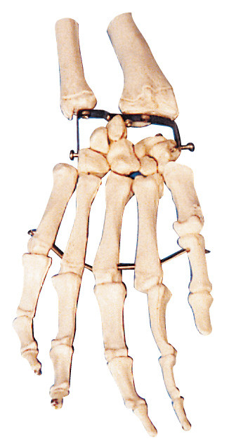 Modelo de entrenamiento humano del modelo de la anatomía del hueso de la palma para la Facultad de Medicina