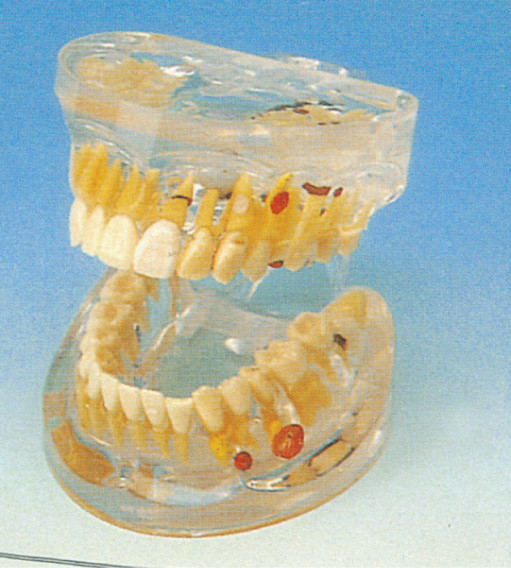 Modelo humano de los dientes de la patología dental transparente adulta para el entrenamiento de las universidades