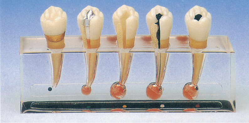 El modelo clínico de la patología del Endodontics incluye 5 porciones para el entrenamiento de la clínica
