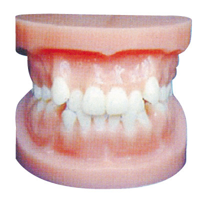 El implante dental modela/modelo ortodóntico para el entrenamiento anatómico