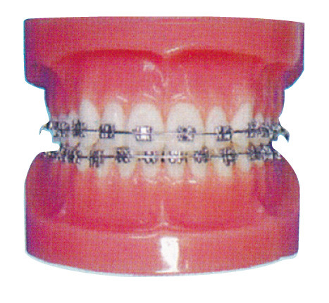 Modelo humano ortodóntico de los dientes para los hospitales y el entrenamiento dental del hospital