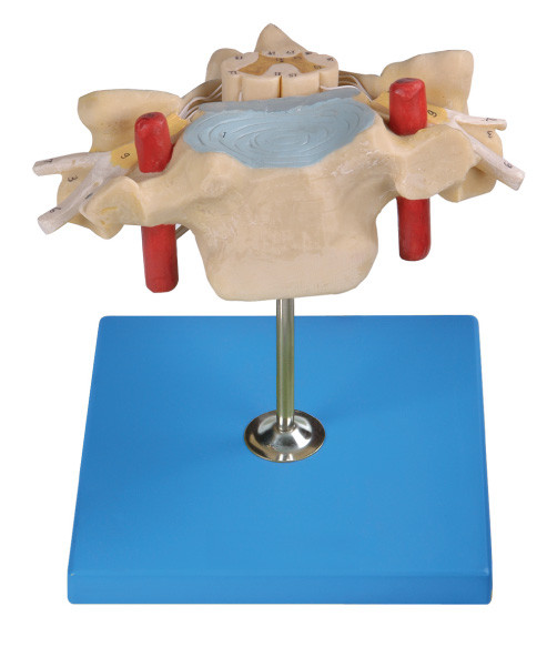 Vertrebra cervical con el modelo humano de la anatomía de la médula espinal muestra la arteria espinal, vena, nervio