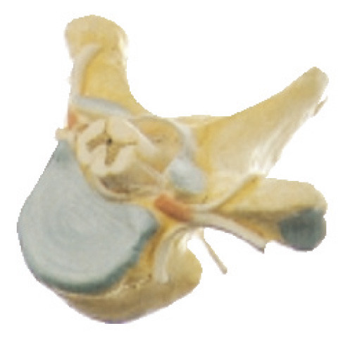 Vertrebra torácico con el modelo humano de la anatomía de la médula espinal en el corte transversal para el simulador médico