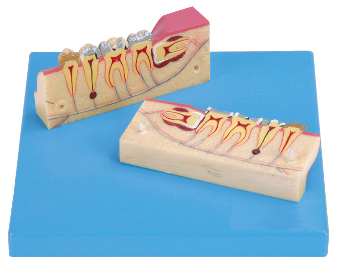 12 posiciones se exhiben del modelo Dissected del tejido de los dientes