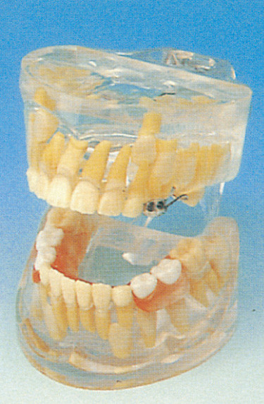 Modelo humano de los dientes de las escuelas dentales/modelo transparente del desarrollo de dientes de leche