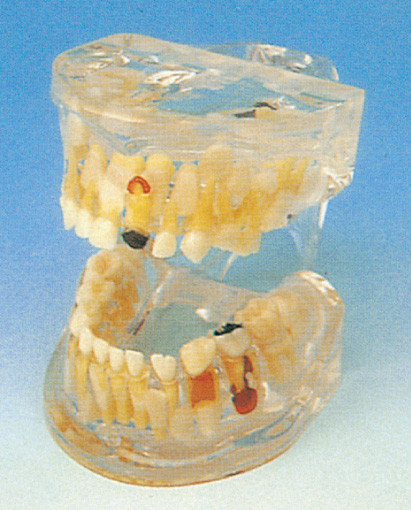 El modelo humano de los dientes/la patología lúcida de los dientes de leche modela para el entrenamiento de las escuelas dentales
