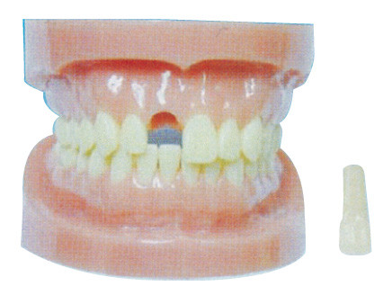 Modelo desmontable de los dientes sin la raíz para los hospitales y el entrenamiento dental de la prevención