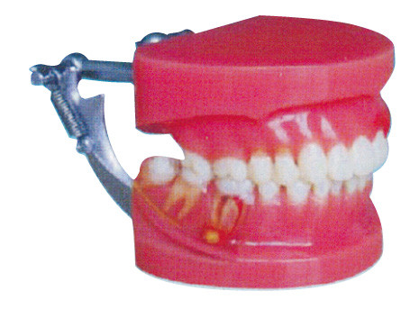 General modelo doctor de la enfermedad periodontal de los dientes humanos rojos y blancos de la demostración