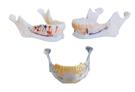 Los dientes del dentista modelan el modelo de la mandíbula con los nervios, las arterias y las venas