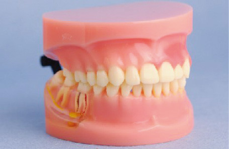 Modelo del modelo humano de los dientes de la enfermedad periodontal para las universidades médicas y el entrenamiento de la clínica